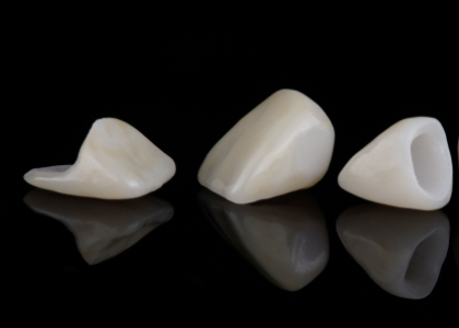 Dental Crowns